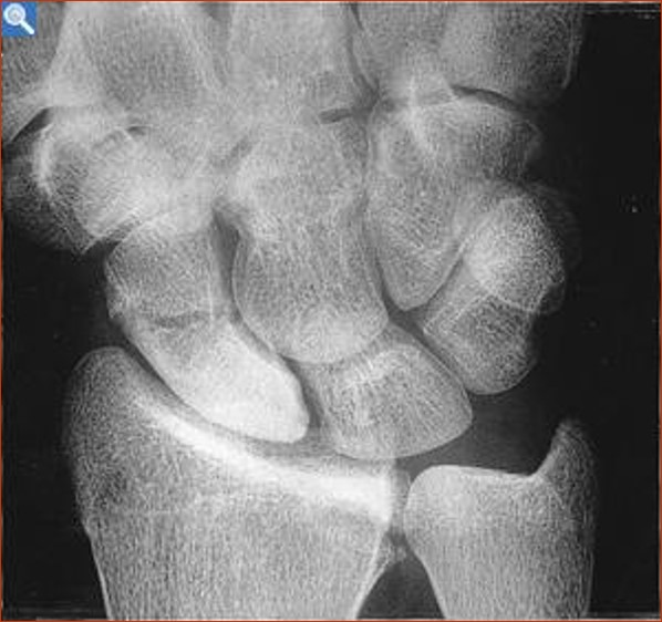 <p>What is the diagnosis?</p>