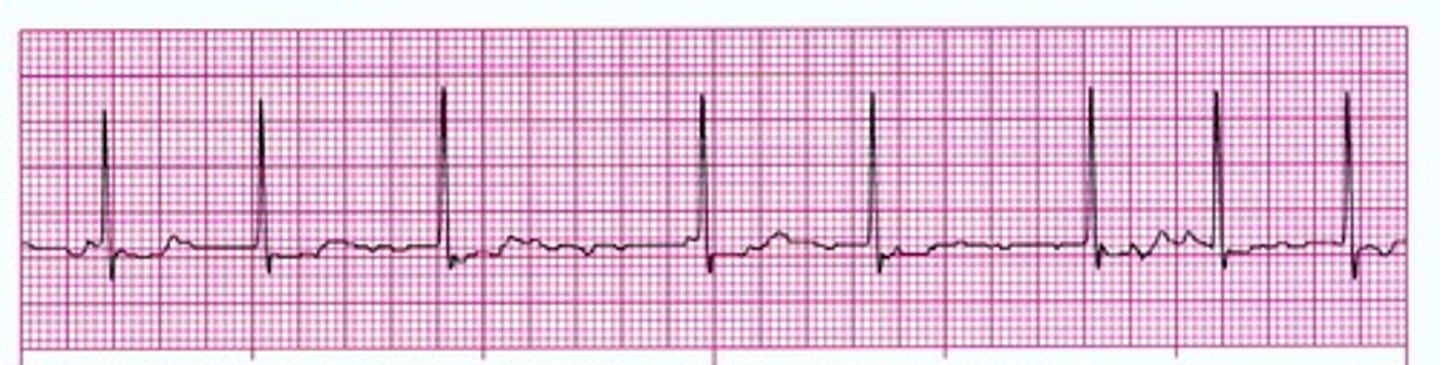 <p>cardioversion</p>