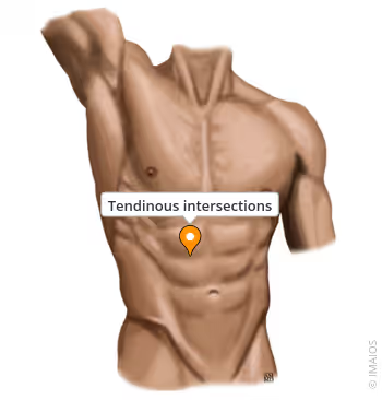 <p>Tendinous Intersections</p><ul><li><p>transverse fibrious bands > segment rectus abdominis into compartments - improving mechanical effciency / force transmission </p></li><li><p>limits bulging / enhancing structural support under tension</p></li></ul><p></p>