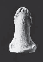 <p>distal hand phalanges (posterior)</p>