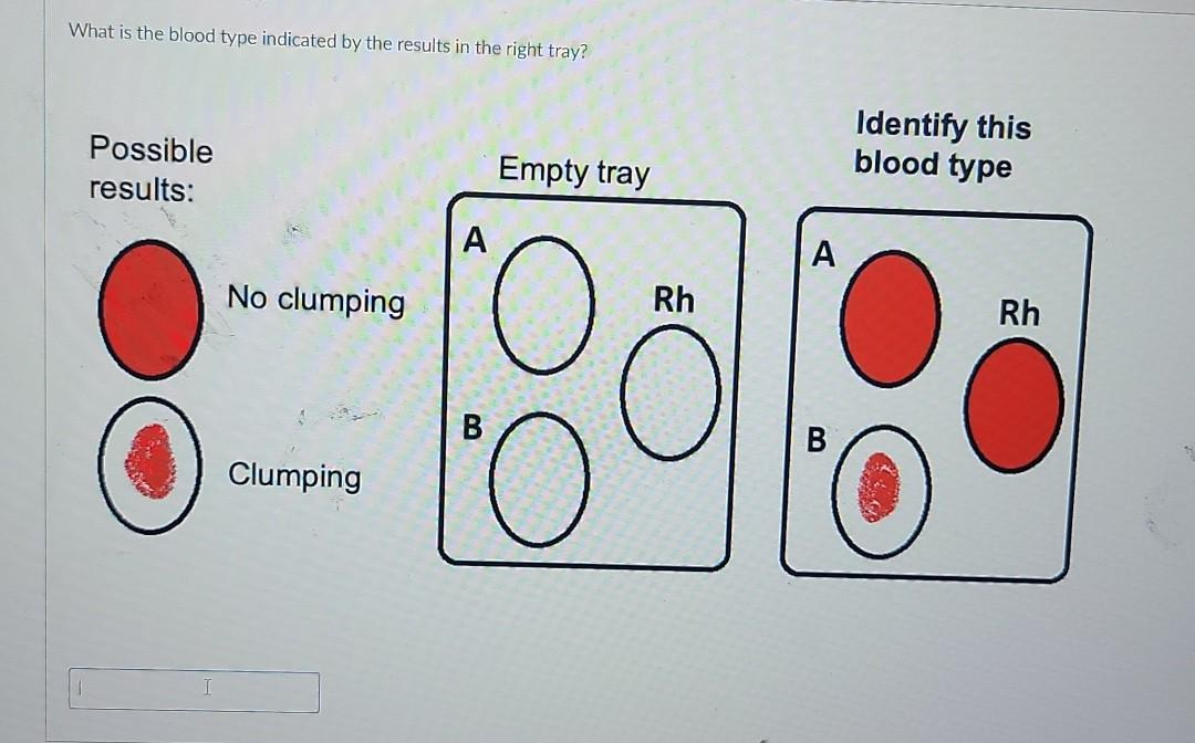 <p>What is the blood type indicated by the results in the right tray?</p>
