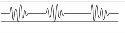<p>Biot Respirations </p>
