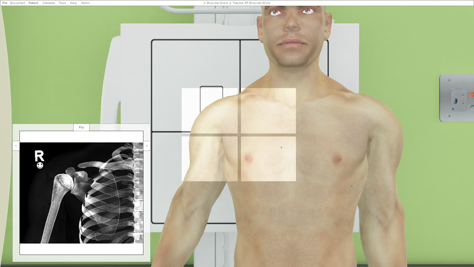 <p>erect with back against the erect bucky, slight rotation to the side of interest so the side of interest is in contact with the bucky</p>