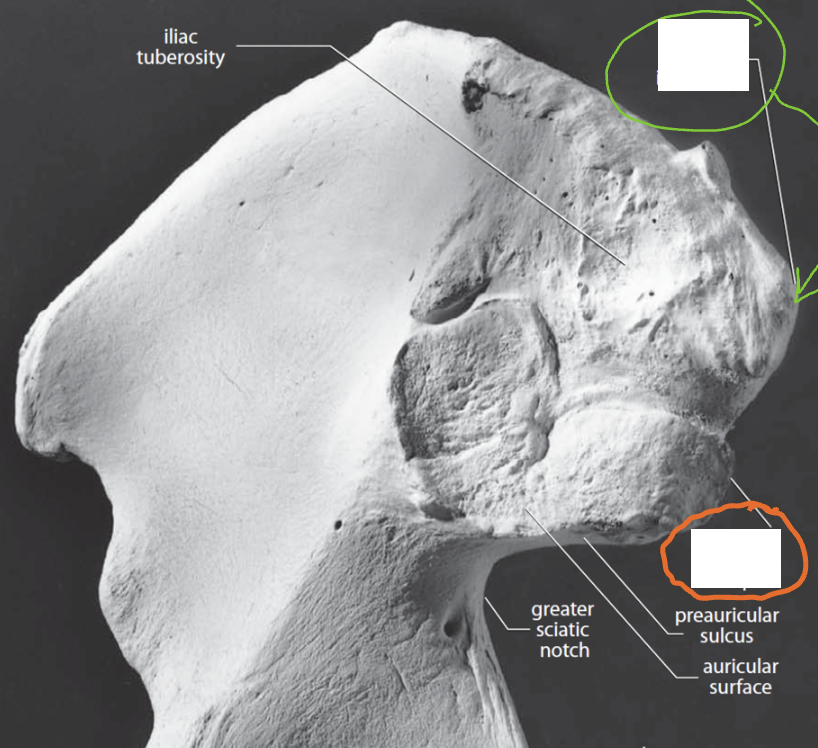 <p>Pelvis: What is the Orange?</p>