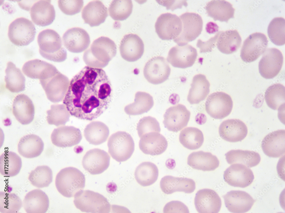 <p>Name the leukocyte</p>