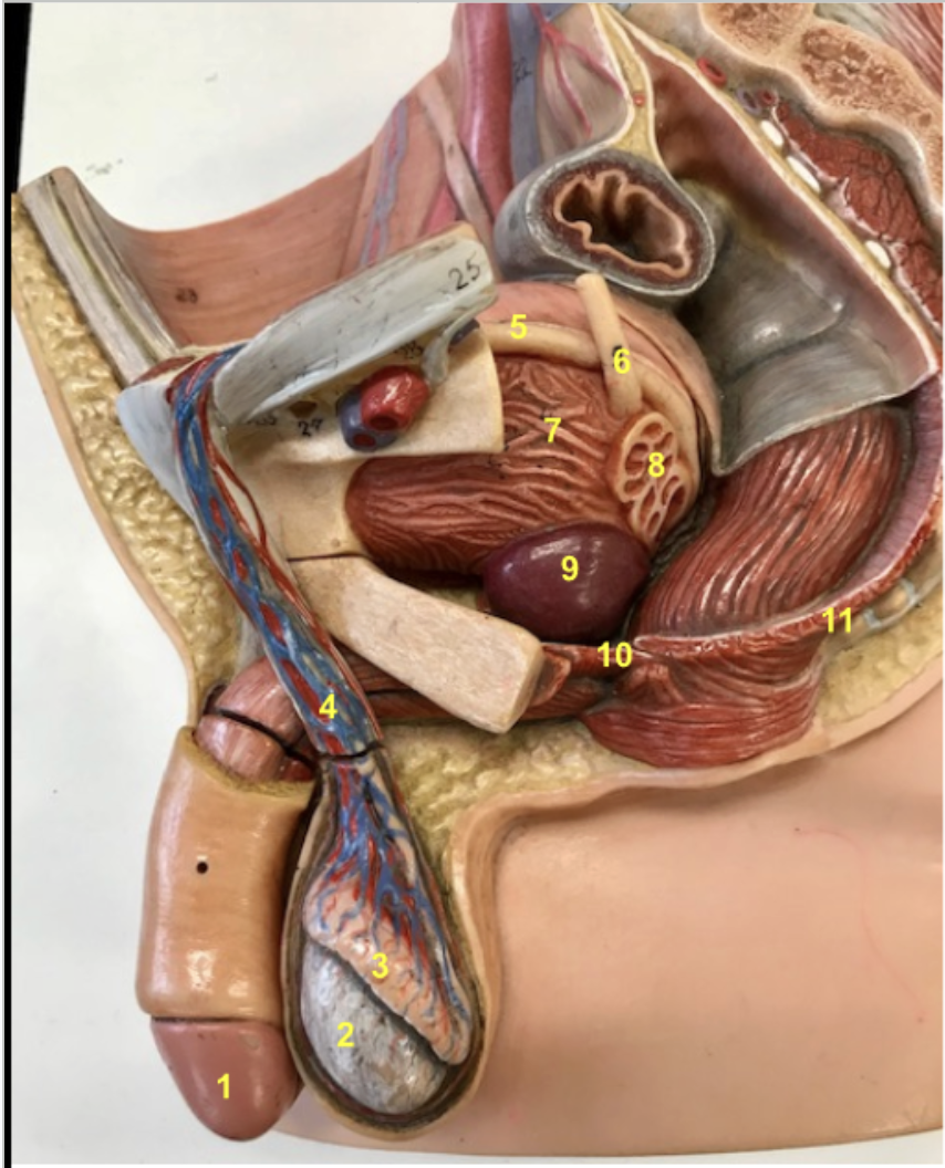 <p>Identify 1-11</p><p>#4 is made up of what structures?</p>