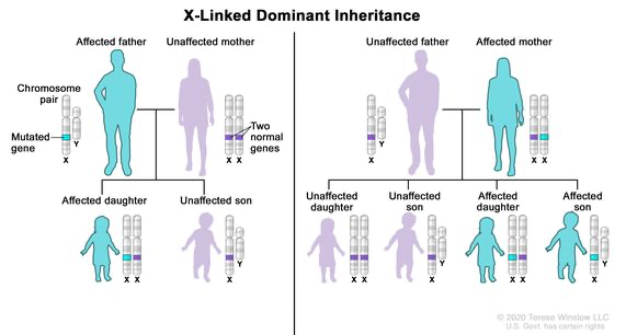 <ul><li><p><span>Individuals only require one copy of the allele to be affected</span></p></li><li><p><span>Much less common than X-linked recessive</span></p></li><li><p><span>Predominatly in females as males with X-linked dominant traits experience more severe/lethal symptoms without the compensation of another X chromosome </span></p></li><li><p><span>There are no carriers as the heterozygote female expresses the trait (and men can't be carriers)</span></p></li></ul><p></p>