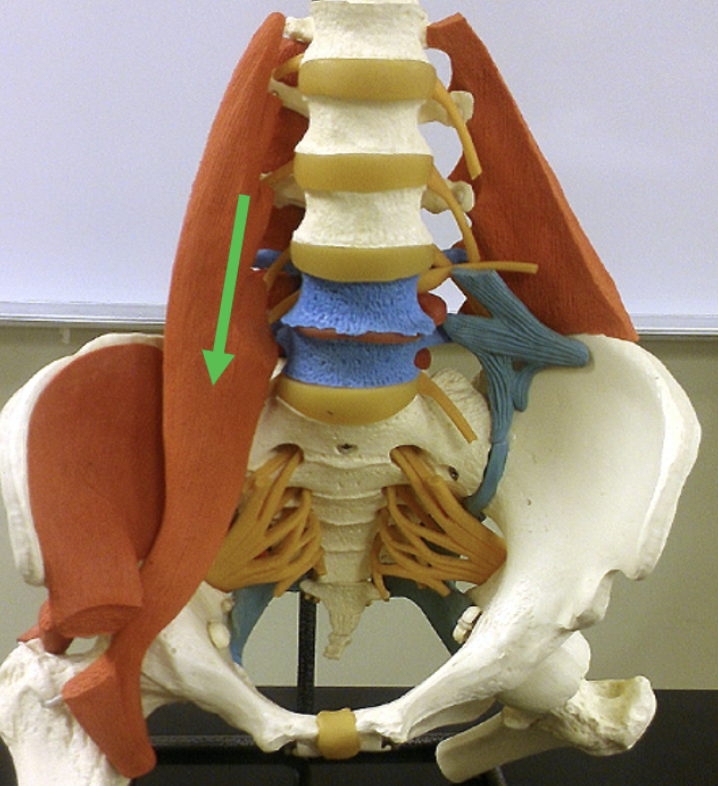 <p>Identify the muscle indicated by the pointer.</p>