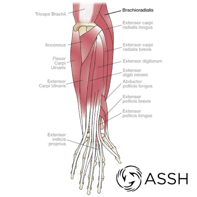 <p>muscle strains &amp; avulsions</p>