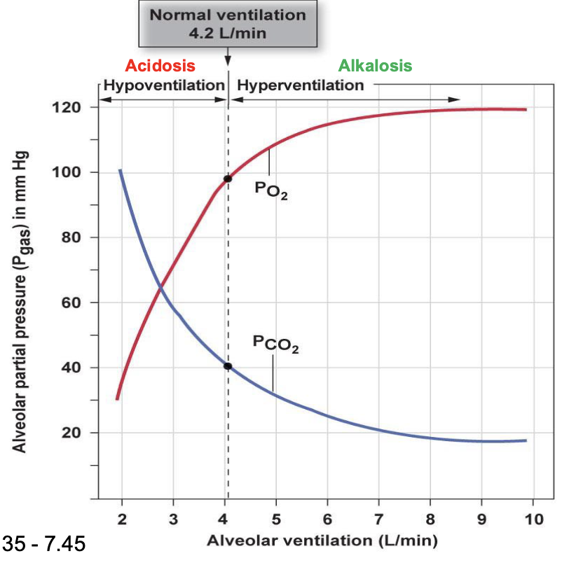 <ul><li><p>elevated levels of CO2 in the blood</p></li></ul><ul><li><p>respiratory acidosis</p></li><li><p>pH decreases and in a more acidic state</p></li><li><p>not blowing off as much CO2</p></li><li><p>consumption of O2 out paces the amount coming in so O2 levels starkly decrease</p></li></ul><p></p>