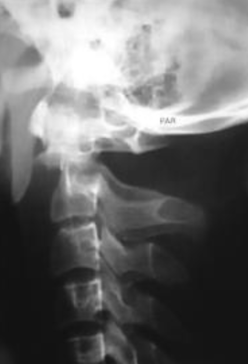 <p>What is the diagnosis?</p>