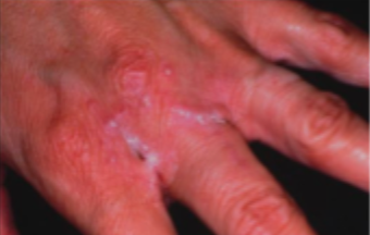 <p>what is this condition</p>