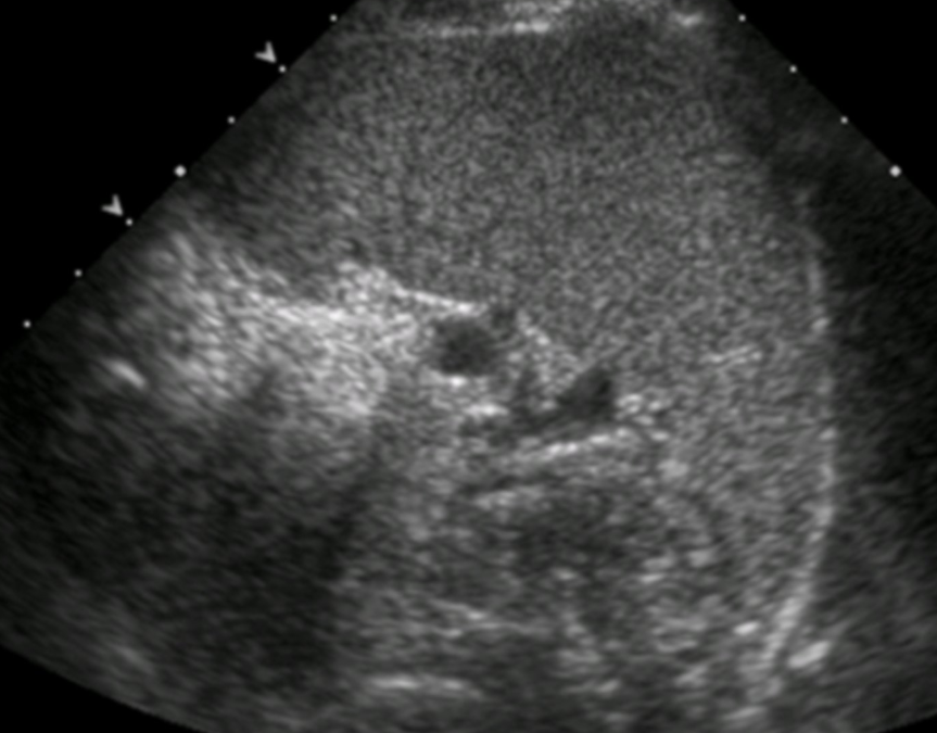 <p>Transverse or long view?</p>