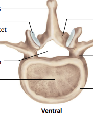 <p>Label the following:</p><ul><li><p>spinous process</p></li><li><p>lamina</p></li><li><p>pedicle</p></li><li><p>vertebral arch</p></li><li><p>annular apophysis</p></li><li><p>vertebral body</p></li><li><p>vertebral foramen</p></li><li><p>transverse process</p></li><li><p>superior articular facet</p></li></ul><p></p>