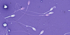 <p>Is this diff quick or eosin-nigrosin stain (hancock)</p>