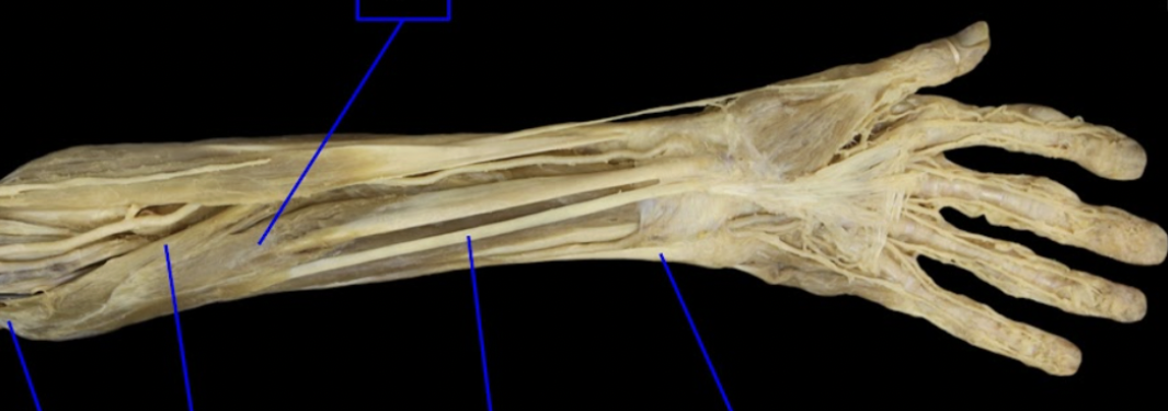 <p>what is the 5th tagged (from left to right) area? Then state the origin, insertion, and main actions.</p>