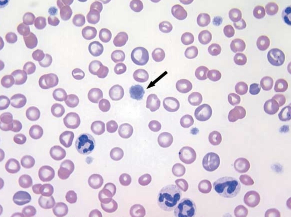 <p>Describe these platelets</p>