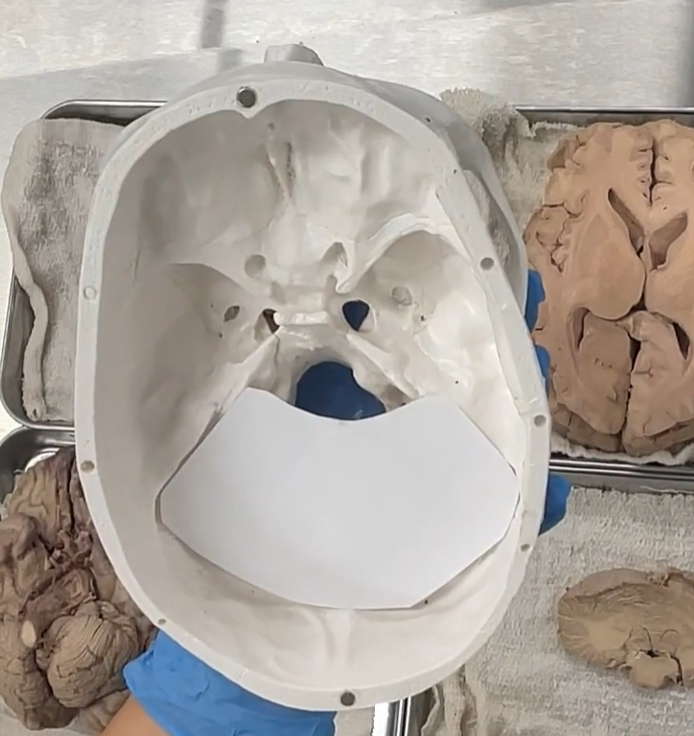 <p>Tentorium Cerebelli </p><p>she cut out a piece of paper to show the tentorium Cerebelli. </p><p>The tentorium cerebelli is superior to the cerebellum, and inferior to the cerebrum. </p>