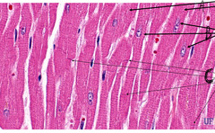 <p>What is indicated by the arrows labeled 'B' in this slide of dog heart?</p>