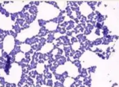 <p>cells are colored by dye while the background is not stained, generally white</p><ul><li><p><strong>ex:</strong> Bacteria appear <strong>purple or blue</strong>, while the background stays mostly clear.</p></li></ul><p></p>
