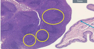 <p>What is this a histological section of</p>