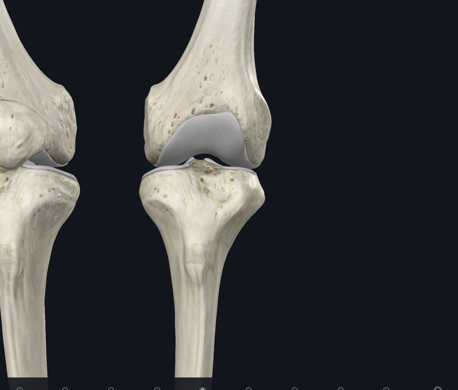 <p>Anterior View</p><p>Joint</p>