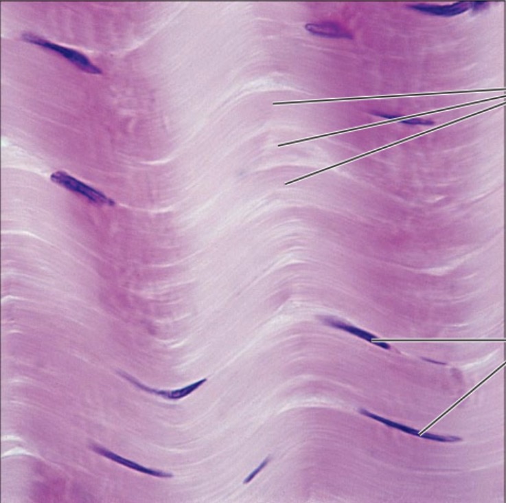 <p>what is the name of this tissue?</p>