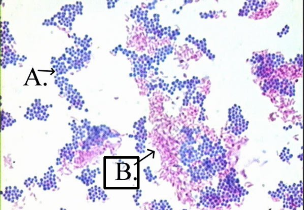 <p>Appear bright <strong>fuchsia</strong>, <strong>pink</strong>, or <strong>red</strong>. They resist decolorization and retain the primary stain (carbol fuchsin).</p>