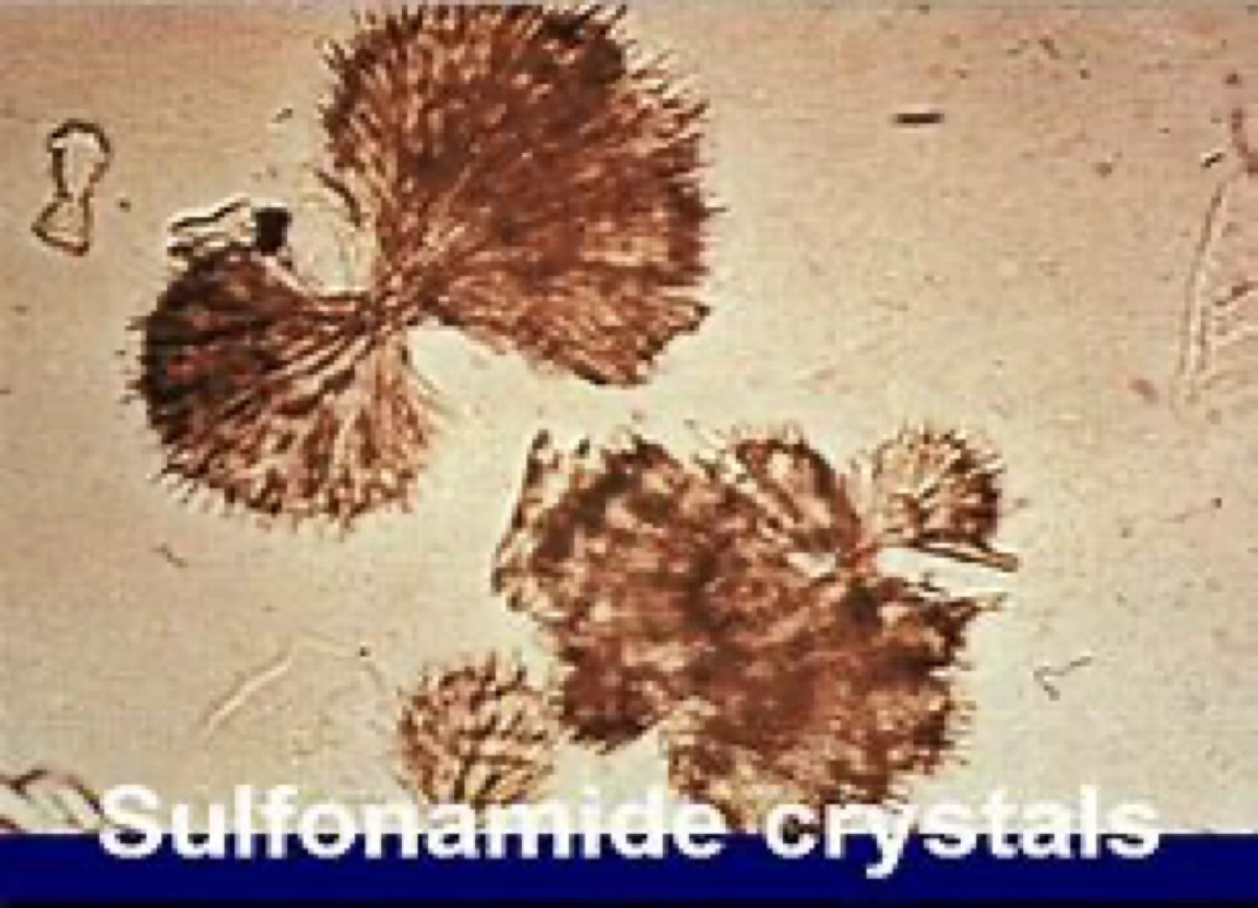 <ul><li><p>Seen in animals treated with sulfonamides.</p></li><li><p>Less likely to be observed in alkaline urine because they are more soluble in alkaline urine.</p></li></ul><p></p>