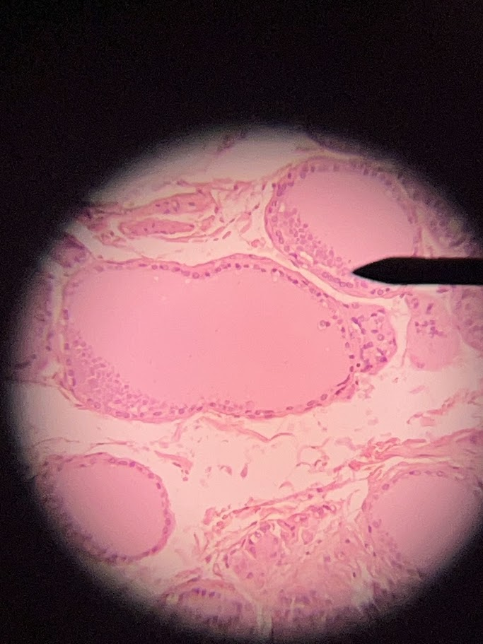 <p>This slide depicts which endocrine gland</p>