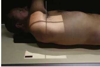 <p>AP OBLIQUE (RPO/LPO): <strong>STEEPER BODY ROTATION</strong></p>