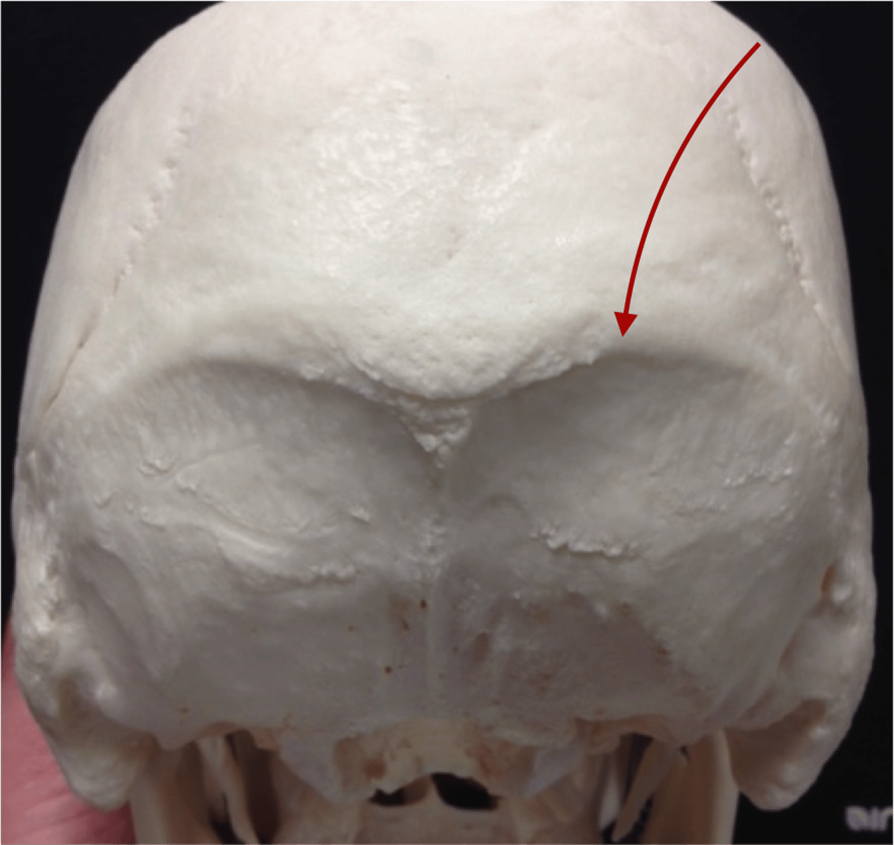 <p>What boney feature is this?</p>