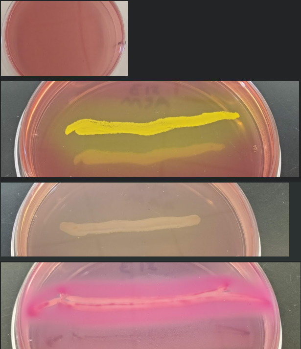 <p><span>You have a patient with intestinal distress, who has eaten eggs contaminated with </span><em>Salmonella enterica. </em><span>You request a stool sample.&nbsp; </span><em>Salmonella </em><span>is a Gram-negative rod that does not ferment lactose or mannitol.&nbsp; It is not a halophile.&nbsp; It is not hemolytic. What would you observe if you plated this sample on a MAC plate?</span></p>