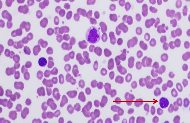 <p>Tế bào gì ?</p>