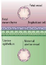 <p>Identify this placental histological classification</p>