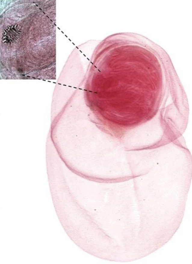 <p>What parasitic worm is this?</p>