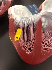 <p>Identify this layer of the heart wall.</p>