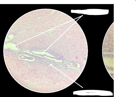 <p>What are the arrows pointing?</p>