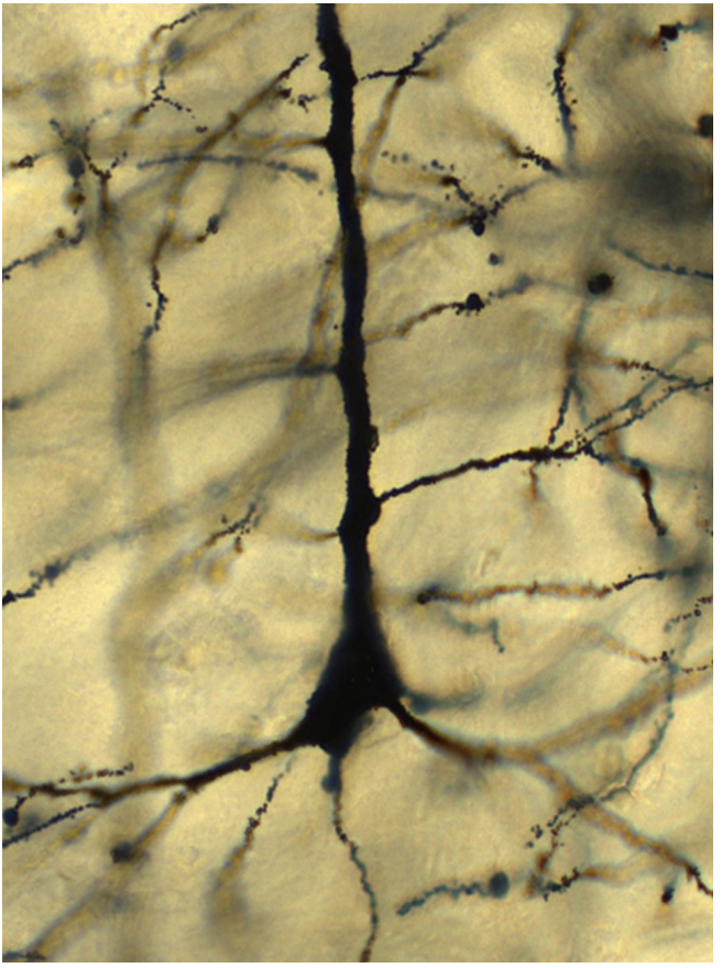 <p>• Location: Cerebral cortex</p><p>• Excitatory</p>