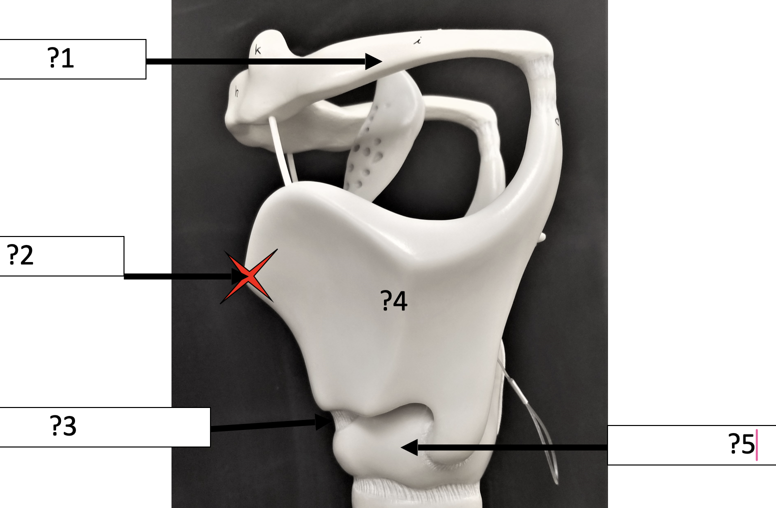 <p>2 Name the specific point?</p>