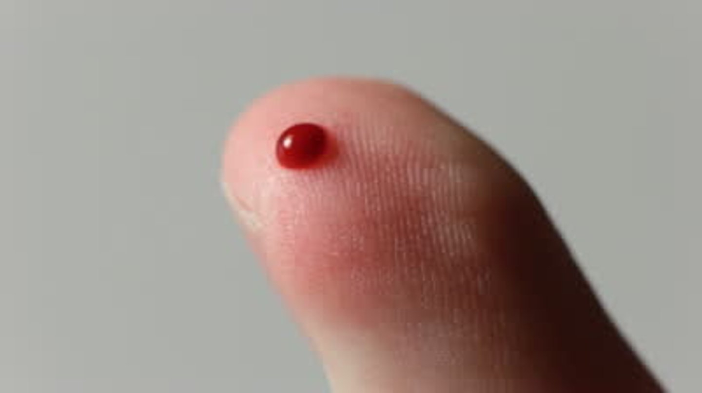 <p>blood</p>