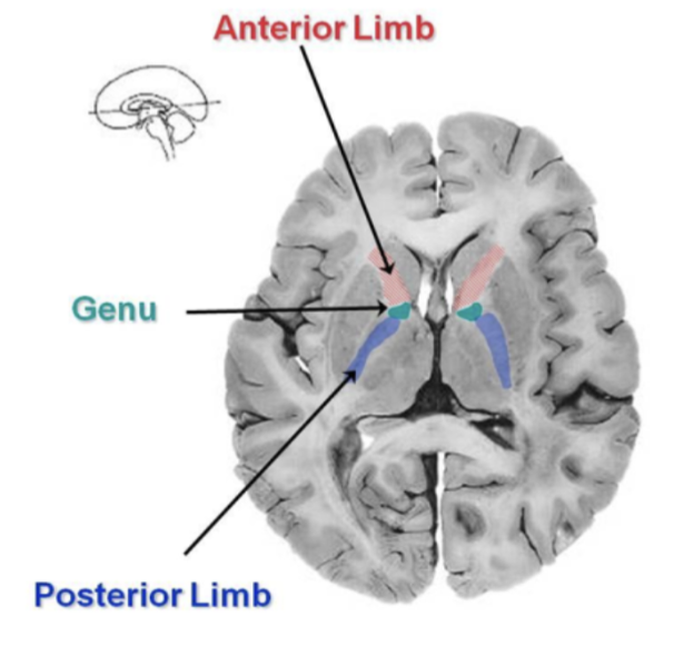 <p>corpus collosum- connects L and R hemisphere</p><p></p><p>corpus radiata- connects cortex to brain stem and thalamus</p><p></p><p>internal capsule- conduit of axons connecting cerebral cortex to other brain areas and spinal cord</p>