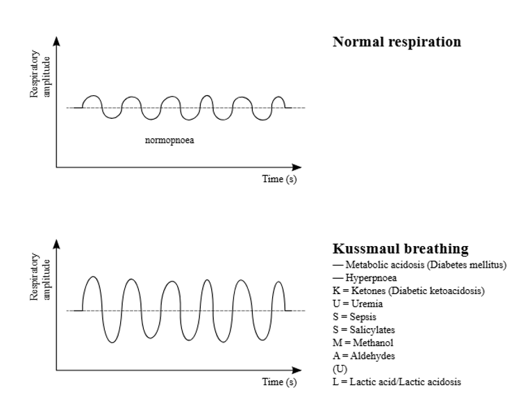 <ul><li><p>příčina</p><ul><li><p>respirační kompenzace metabolické acidózy (hyperkapnie)</p></li><li><p>diabetická ketoacidóza, renální selhání</p></li></ul></li><li><p>dechový vzorec</p><ul><li><p>výrazná hyperpnoe = prohloubené dýchání</p></li><li><p>zvětšená minutová ventilace, velké úsilí </p></li></ul></li></ul><p></p>