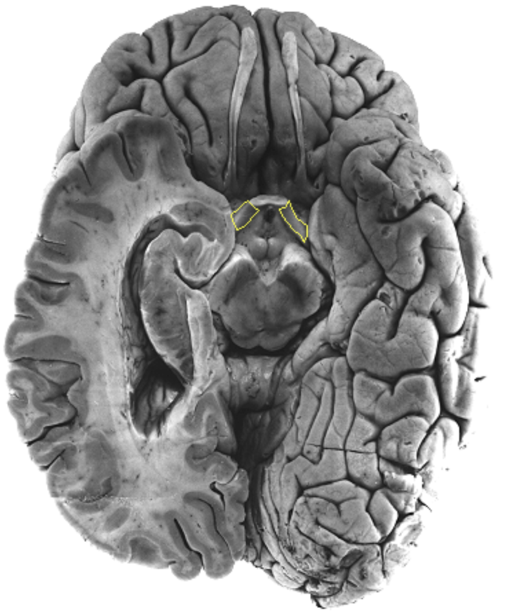 <p>What is the area highlighted called?</p>