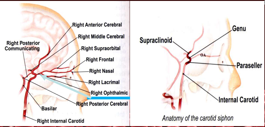 <p><strong>opthalmic artery</strong></p><p><strong>carotid siphon</strong></p>