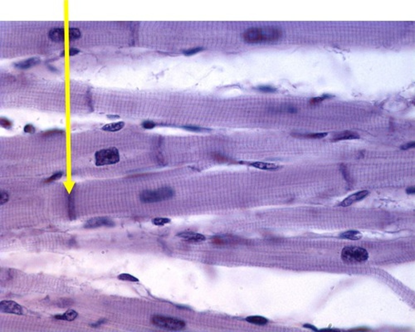 <p>Specialized junctions connecting cardiac cells.</p>