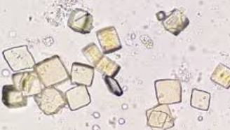 <p>Colorless/yellow-brown, Rosette or Rhomboid form</p><p>Normal, Seen in acidic urine</p>