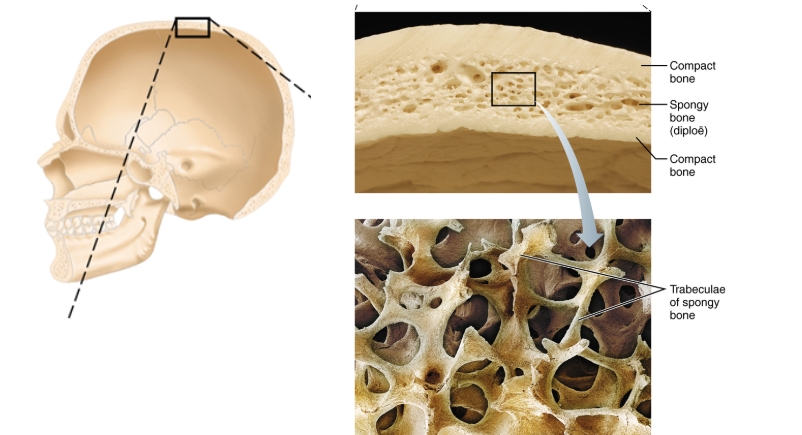 <p>Compact bone borders, spongy bone inside (made of trabeculae of spongy bone)</p>