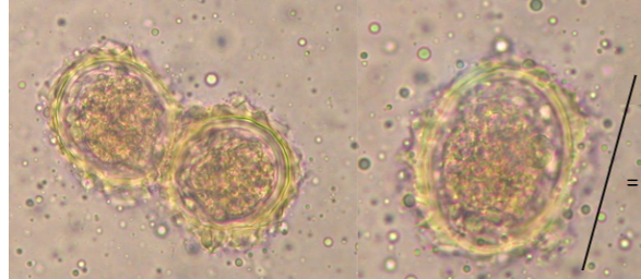 <p>What is this parasite </p>