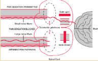 <p>Gate-Control Theory </p>